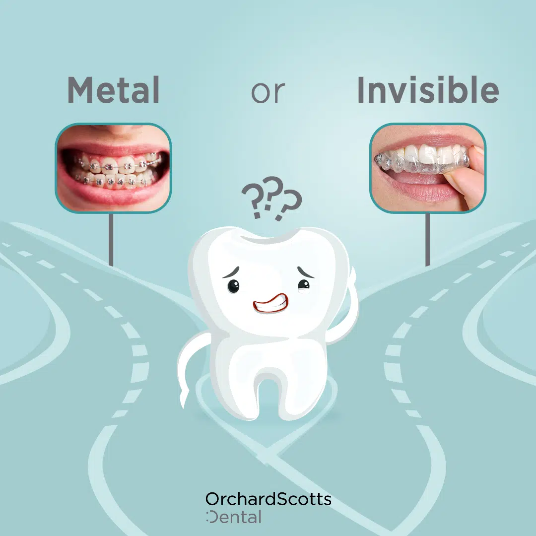 Metal or invisible braces: what’s best for you?