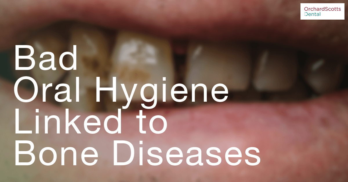 Study: Bad Oral Hygiene Linked To Bone Diseases