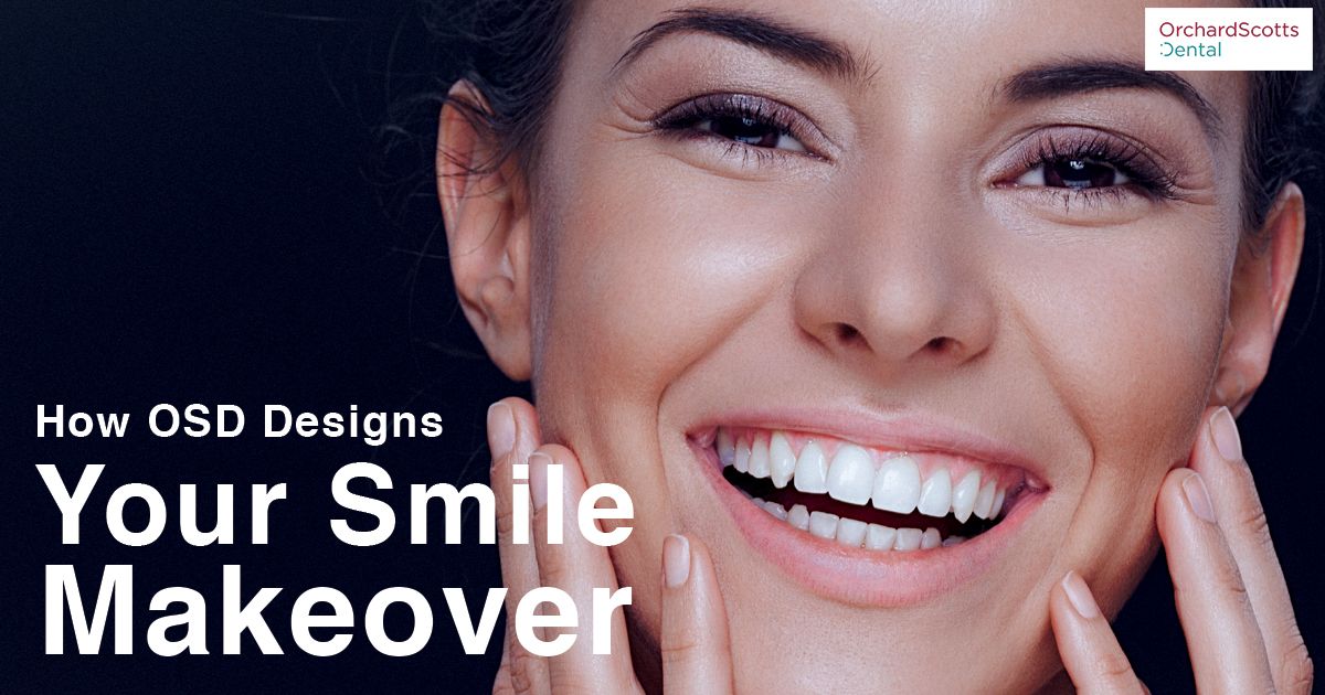 How OSD Designs Your Smile Makeover