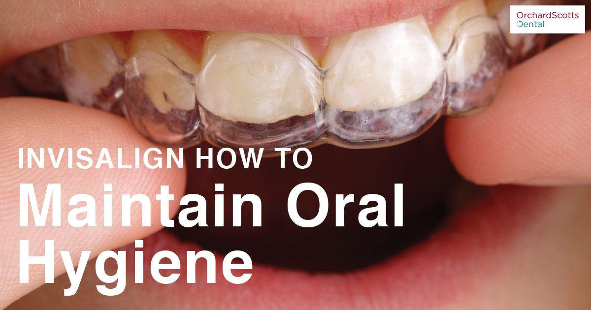 How To Maintain Oral Hygiene With Invisalign