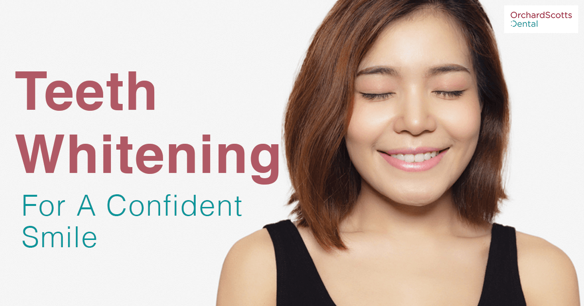 Teeth Whitening For A Confident Smile