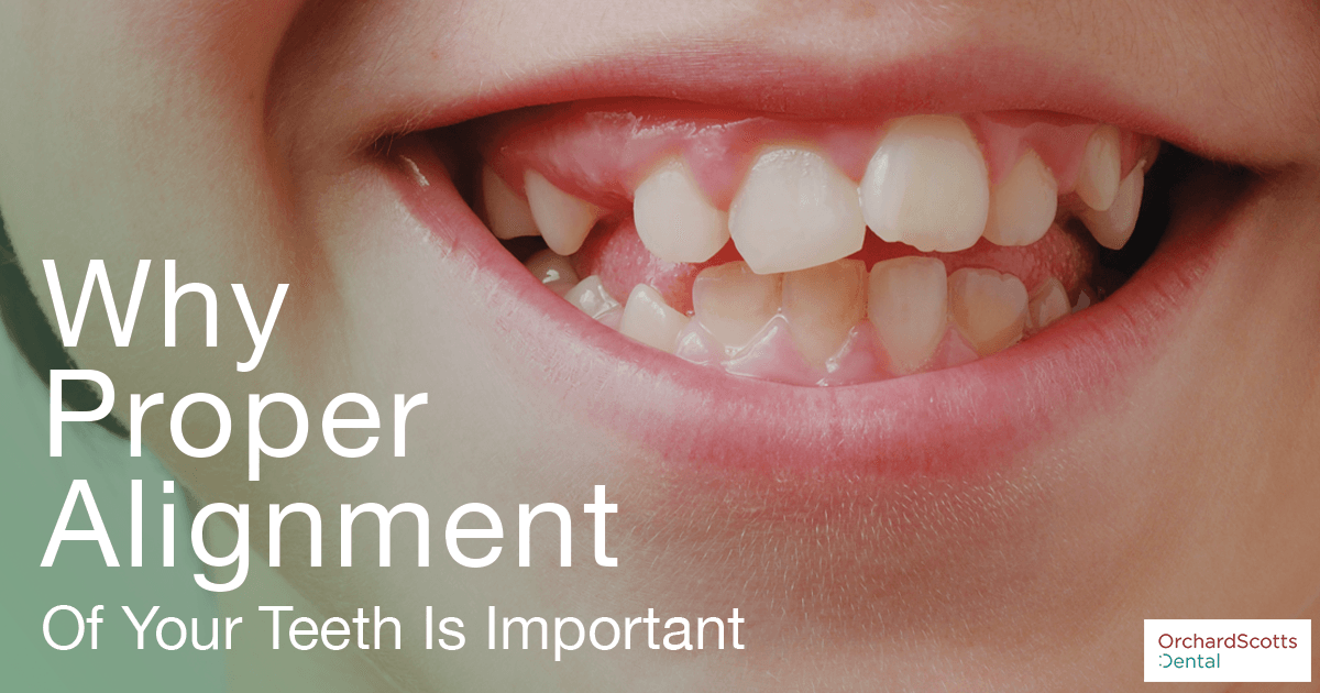 Why Proper Alignment of Your Teeth Is Important