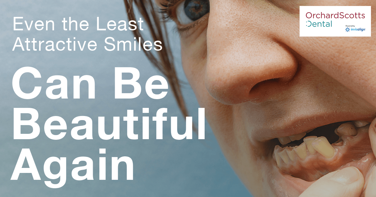 Even the Least Attractive Smiles Can Be Beautiful Again