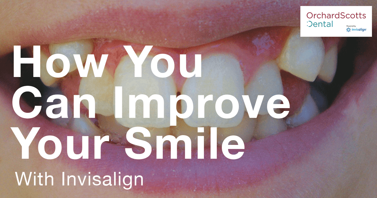 How You Can Improve Your Smile with Invisalign