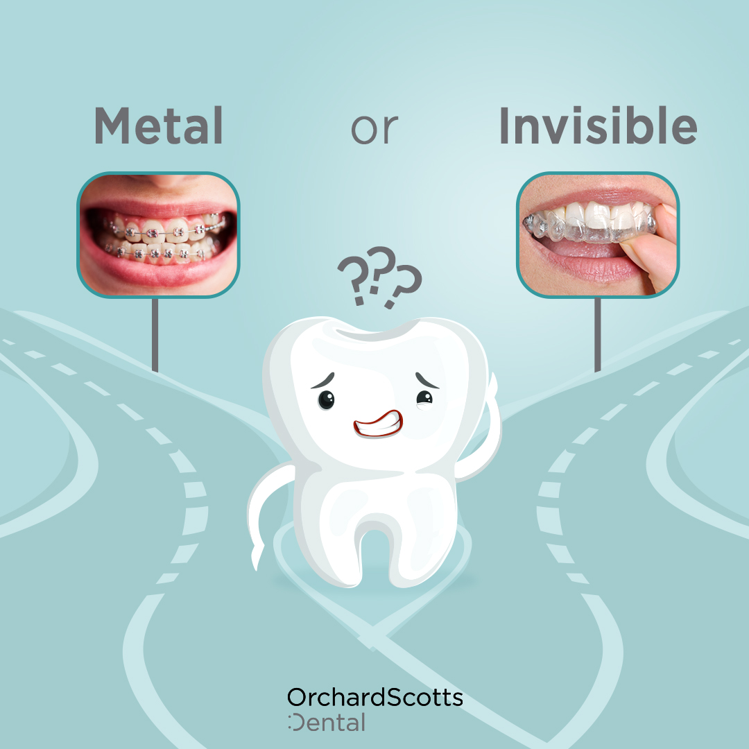 Metal or Invisible Braces: What’s Best for You