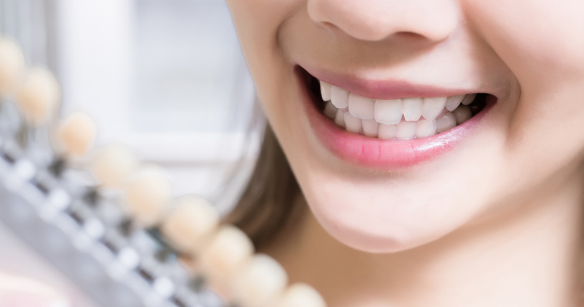 DIY or Professional Teeth Whitening: Making the Right Decision