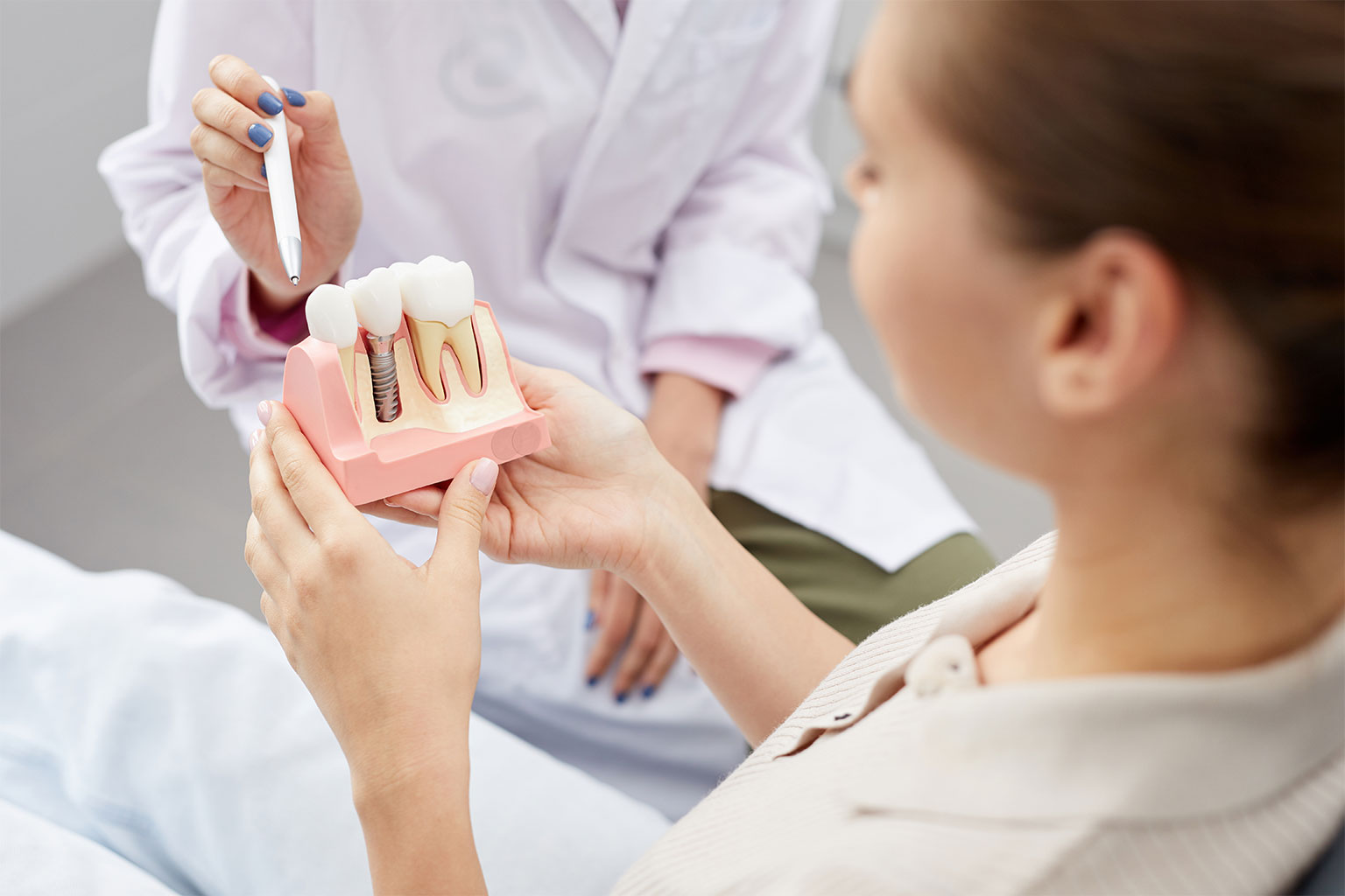 Implants or Bridges for Tooth Replacement?